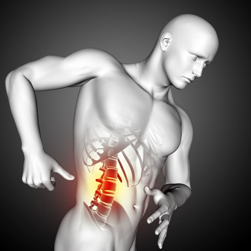 Artrodesis Vertebral Ortopedista Costo