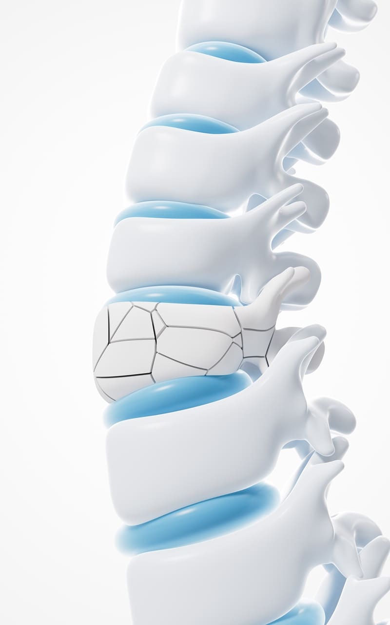 Números de Clínicas Columna Vertebral en CDMX