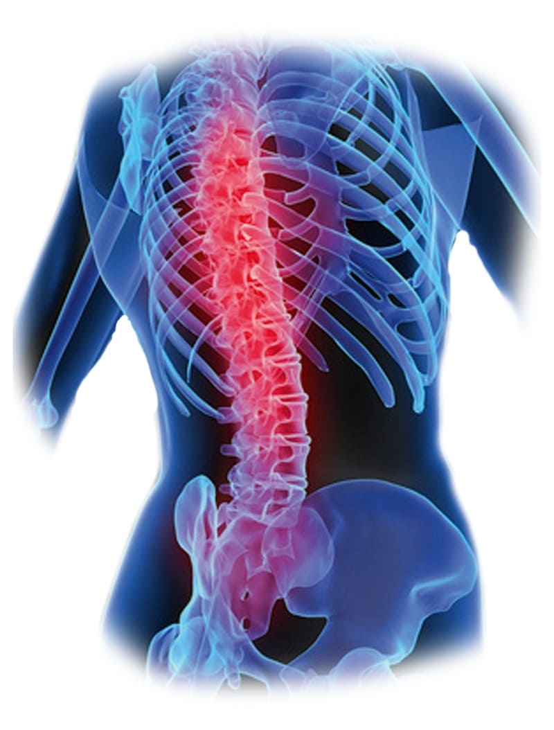 Ortopedista Columna Vertebral Opiniones